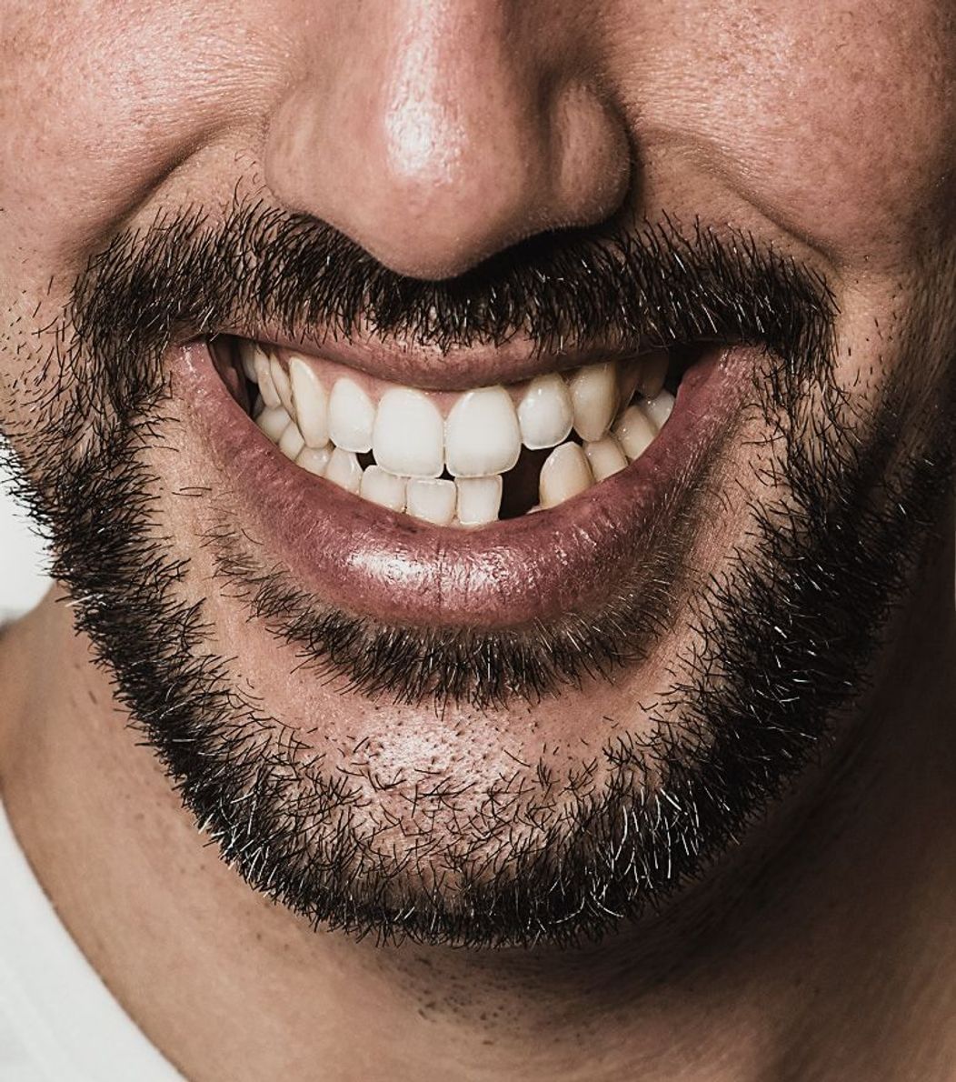 An image of a man smiling showing a missing tooth