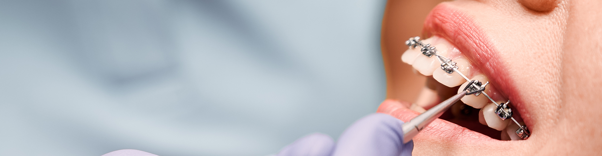 Gloved hand using dental tool in woman's mouth with braces.