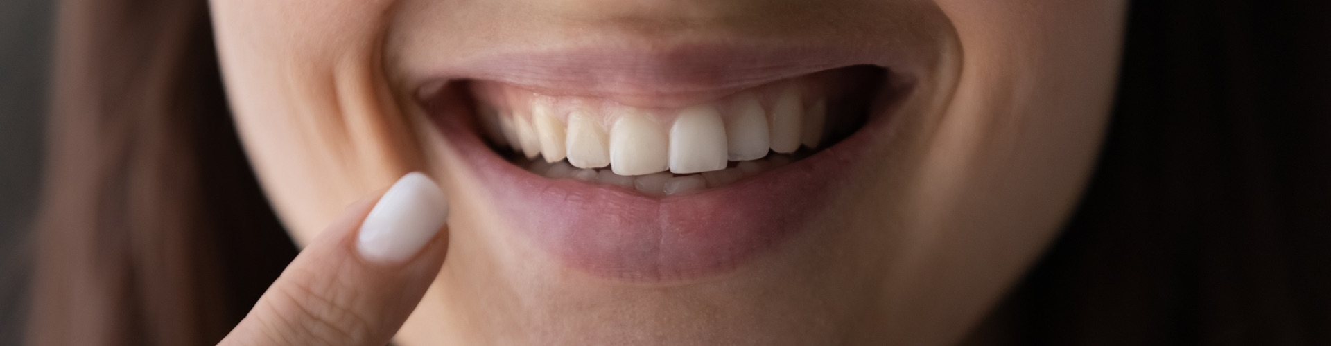 Woman pointing at her smile.