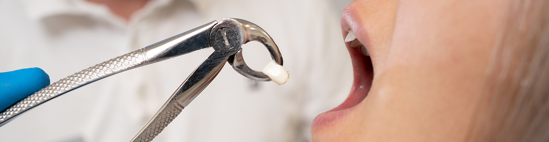 female having a tooth extracted
