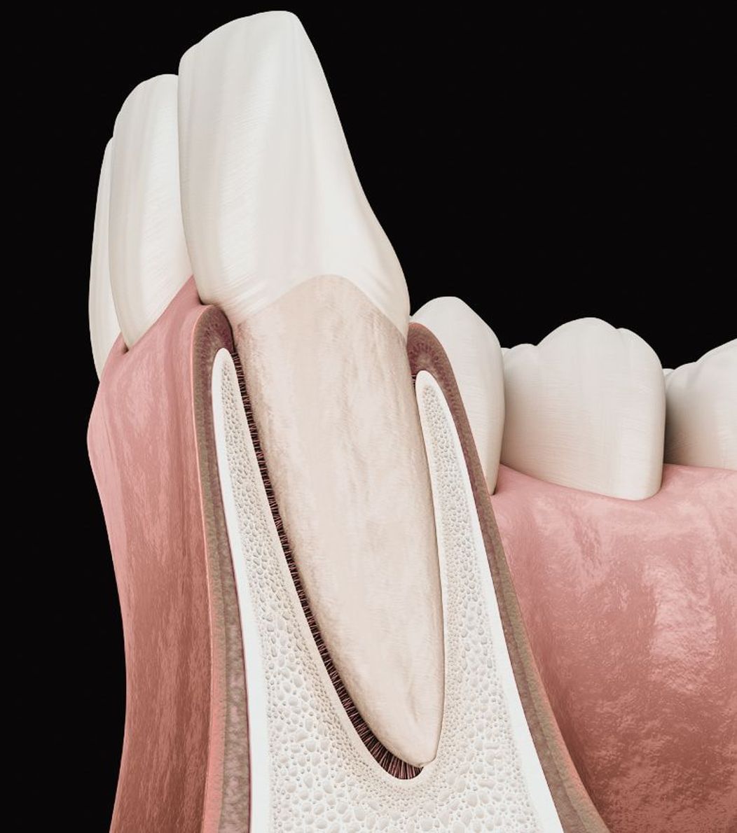 An image of the anatomy of a tooth showing bone support